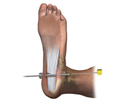foot 2